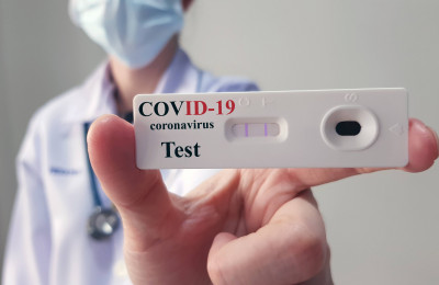 Hospitais, laboratórios e farmácias deverão informar sobre testagem para Covid-19